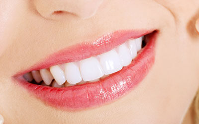 LA Dental Arts-Bershadsky DDS-Los Angeles Dentist-teeth whitening smile