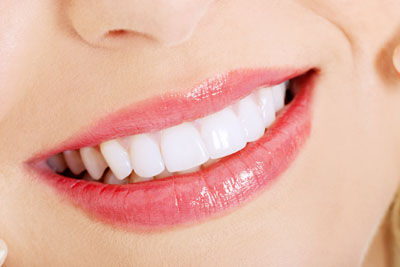LA Dental Arts-Bershadsky DDS-Los Angeles Dentist-teeth whitening smile