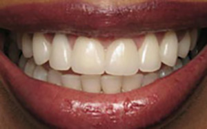 LA Dental Arts-Bershadsky DDS-Los Angeles Dentist-1a