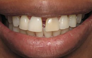 LA Dental Arts-Bershadsky DDS-Los Angeles Dentist-1b