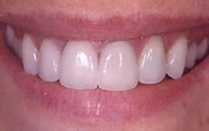 LA Dental Arts-Bershadsky DDS-Los Angeles Dentist-3a