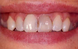 LA Dental Arts-Bershadsky DDS-Los Angeles Dentist-3b