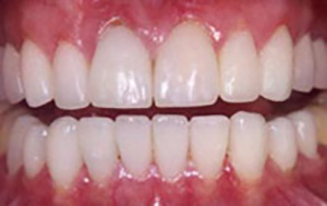 LA Dental Arts-Bershadsky DDS-Los Angeles Dentist-4a LA Dental Arts-Bershadsky DDS-Los Angeles Dentist-4a