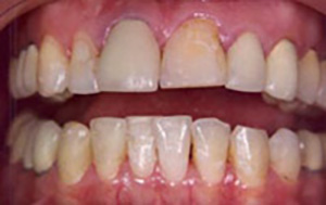 LA Dental Arts-Bershadsky DDS-Los Angeles Dentist-4b