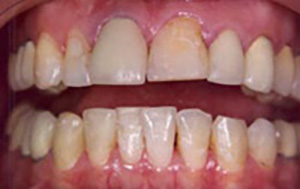 LA Dental Arts-Bershadsky DDS-Los Angeles Dentist-4b LA Dental Arts-Bershadsky DDS-Los Angeles Dentist-4b