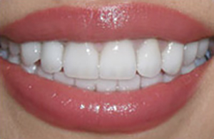 LA Dental Arts-Bershadsky DDS-Los Angeles Dentist-5a LA Dental Arts-Bershadsky DDS-Los Angeles Dentist-5a