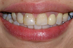 LA Dental Arts-Bershadsky DDS-Los Angeles Dentist-5b LA Dental Arts-Bershadsky DDS-Los Angeles Dentist-5b