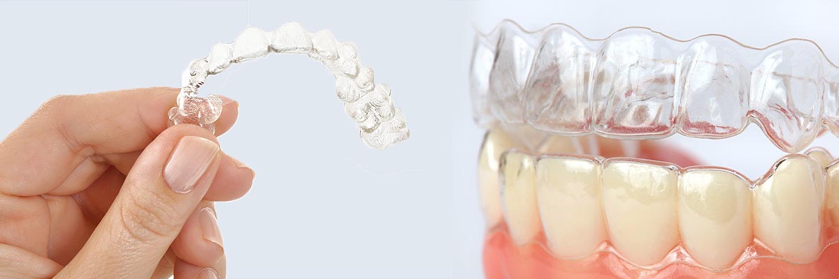 LA Dental Arts-Bershadsky DDS-Los Angeles Dentist-alternative to braces for teens header