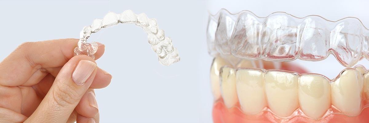 clearcorrect-braces-header