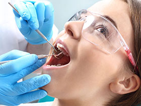 LA Dental Arts - Bershadsky DDS - Los Angeles Dentist - Composite Fillings