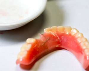 LA Dental Arts-Bershadsky DDS-Los Angeles Dentist-damage my dentures