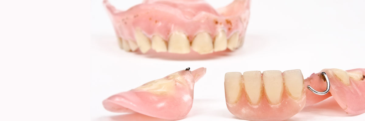 LA Dental Arts-Bershadsky DDS-Los Angeles Dentist-damage my dentures header