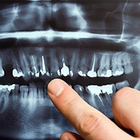 LA Dental Arts - Bershadsky DDS - Los Angeles Dentist - Dental Services Photo2 LA Dental Arts - Bershadsky DDS - Los Angeles Dentist - Dental Services Photo2