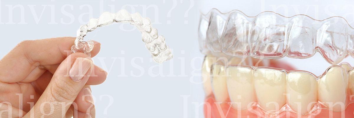 LA Dental Arts-Bershadsky DDS-Los Angeles Dentist-does invisalign work