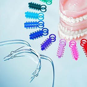 LA Dental Arts-Bershadsky DDS-Los Angeles Dentist-invisalign-vs-traditional-braces