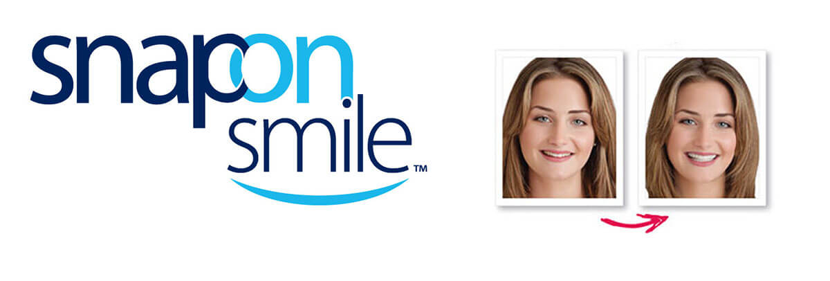 snap-on-smile-header