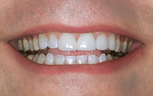 LA Dental Arts - Bershadsky DDS - Los Angeles Dentist - 2A LA Dental Arts - Bershadsky DDS - Los Angeles Dentist - 2A