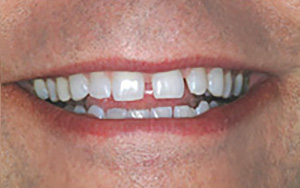 LA Dental Arts - Bershadsky DDS - Los Angeles Dentist - 2B